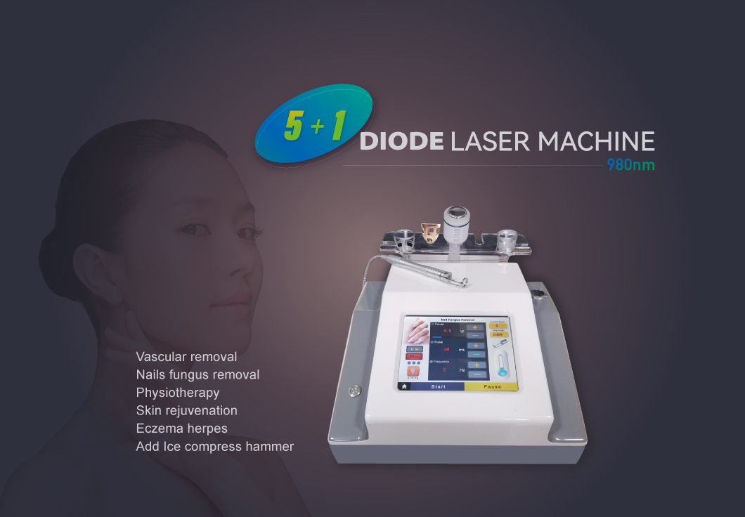 980 nm laser diodi di rimozione vascular