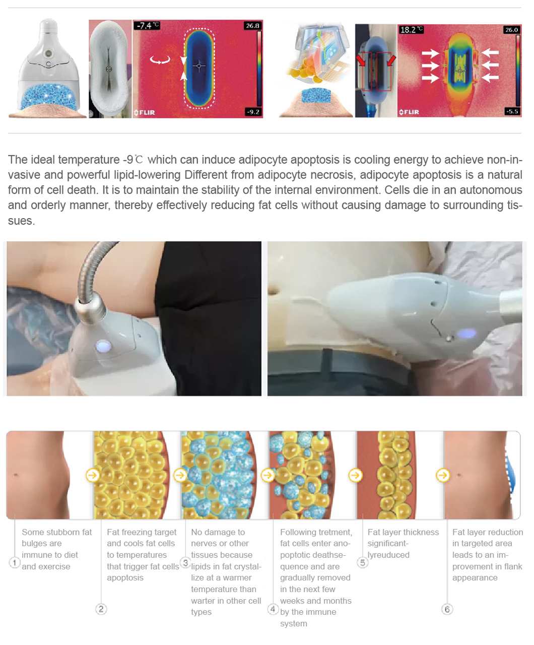 ម៉ាស៊ីនកាត់រាងកាយ cryolipolysis