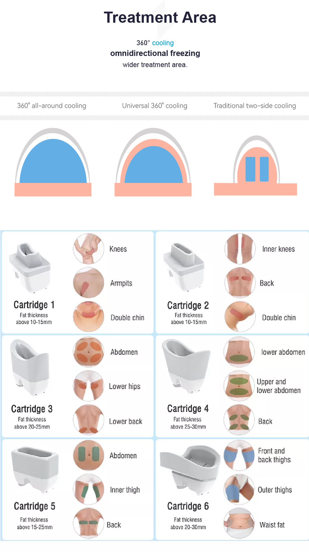 cryolipolysis ចល័ត