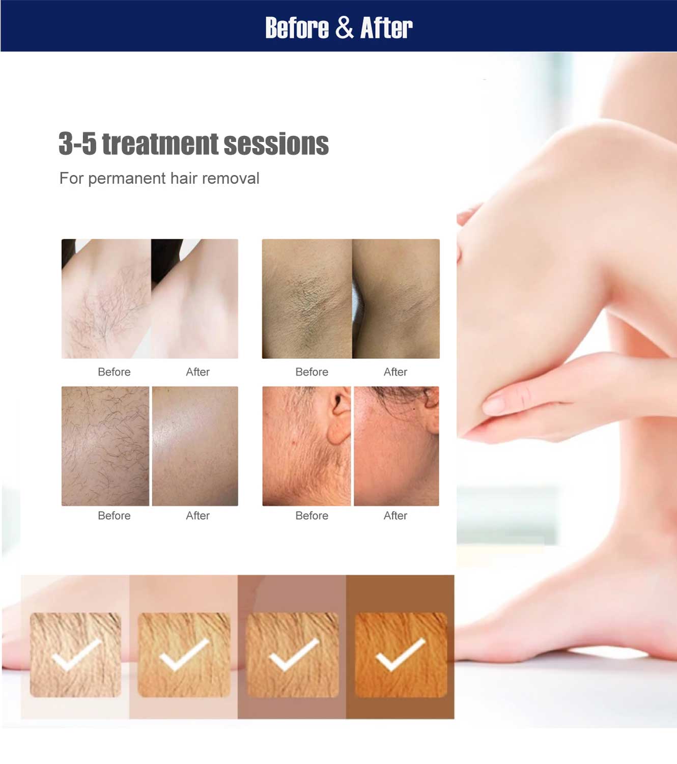808 laser hair removal machine