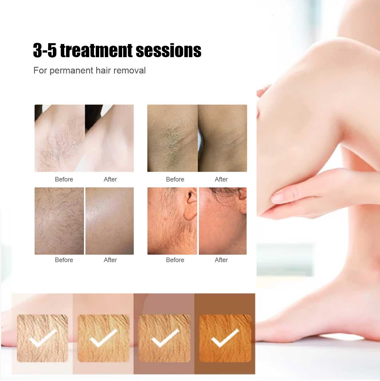 before and after for diode laser