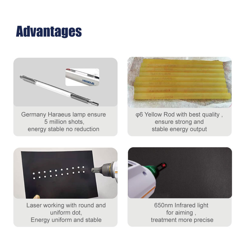 q switch laser machine price
