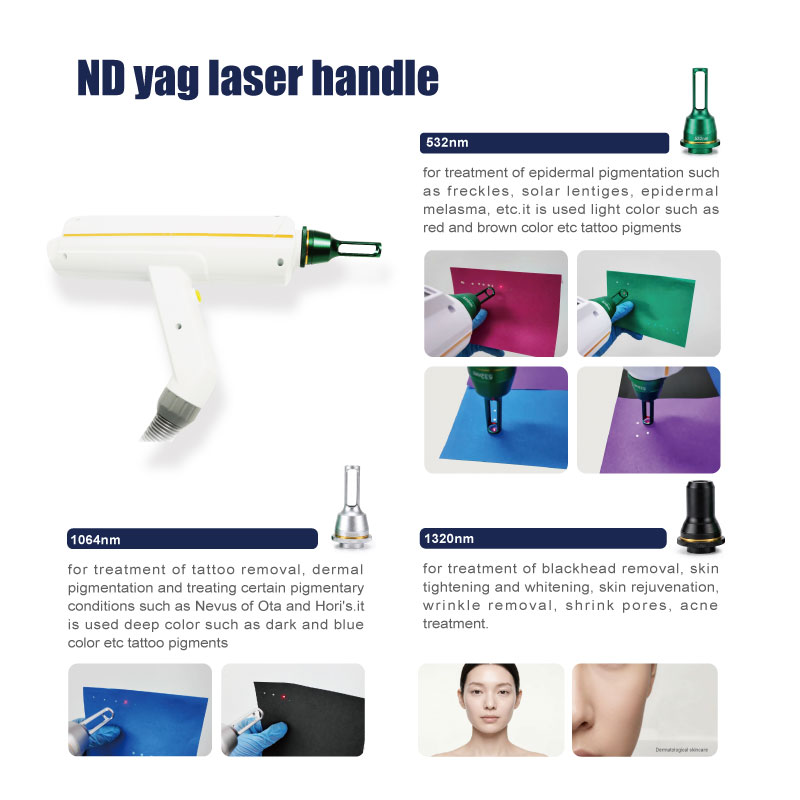 q switched nd yag laser