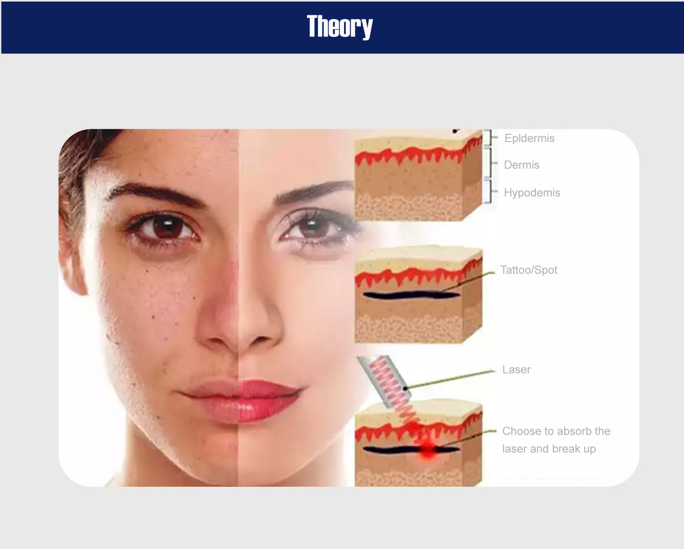 q switched nd yag laser price