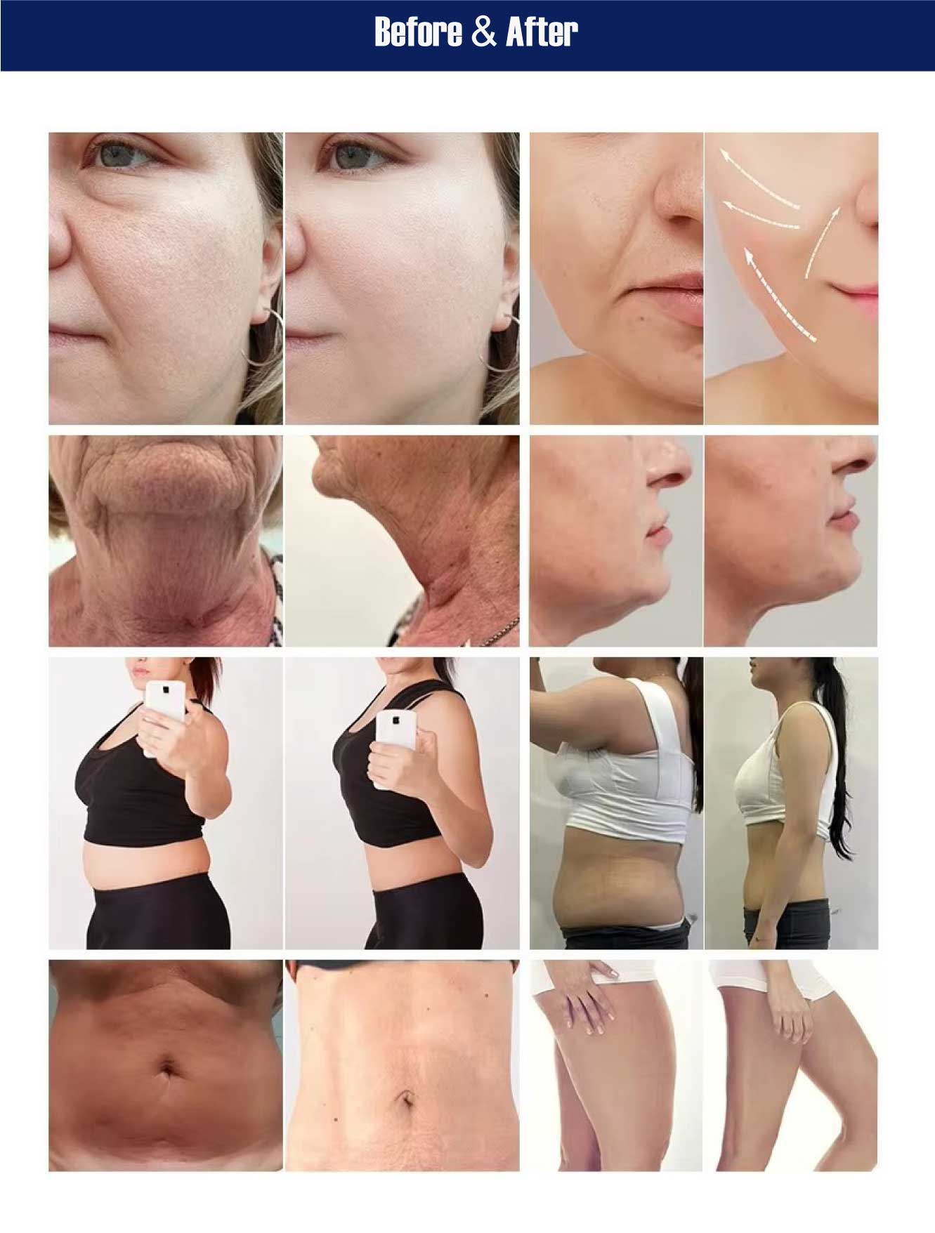 weight loss comparison